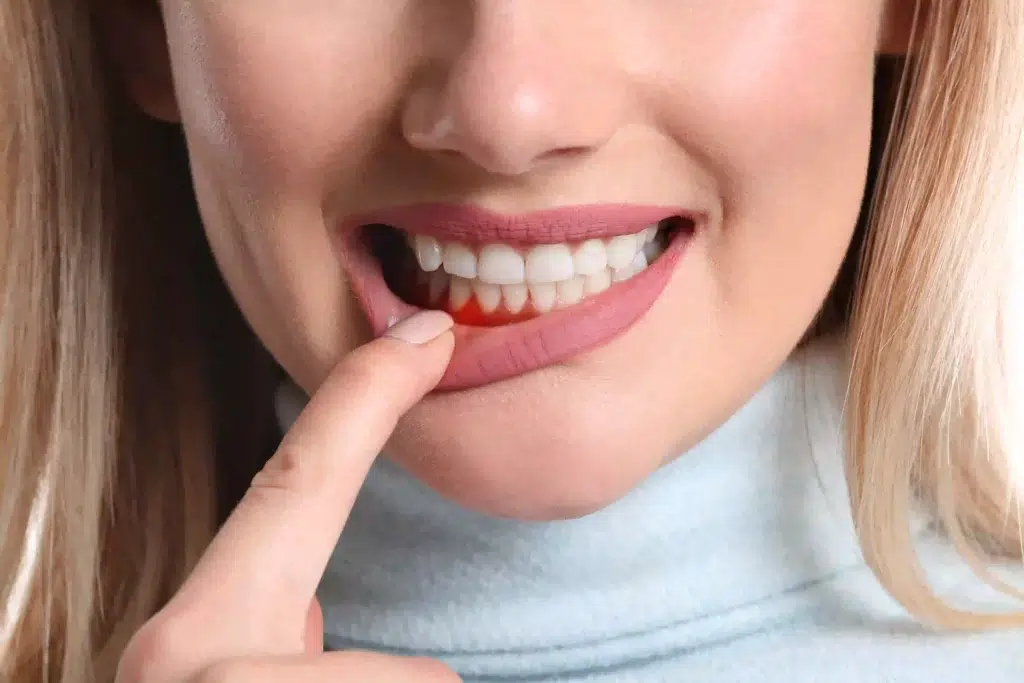 gum dental problems scaled