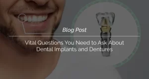 Vital Questions You Need to Ask About Dental Implants and Dentures